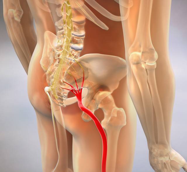 Effective Therapy For Sciatica