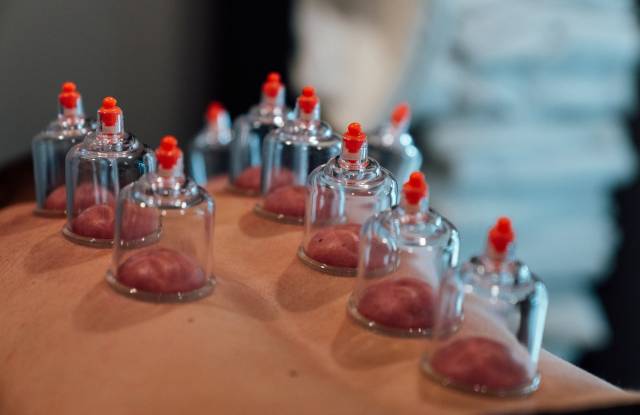 Cupping Therapy For Improved Blood Circulation