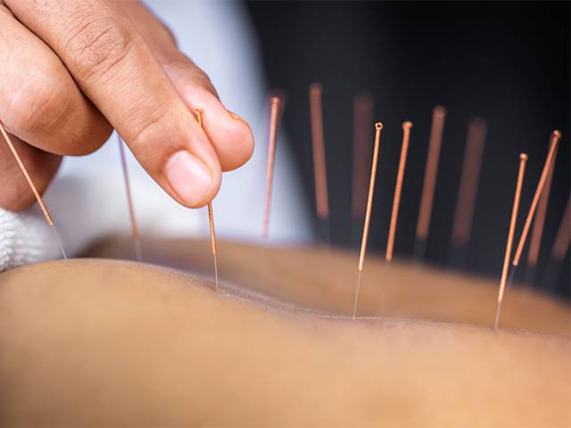 Chinese Acupuncture Therapy