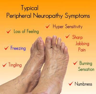 Rare Treatment For Peripheral Neuropathy (Call Or WhatsApp - 08038089801)